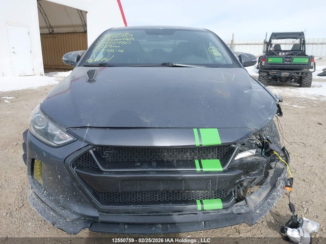 KMHD84LF5HU420760 Hyundai ELANTRA GL
