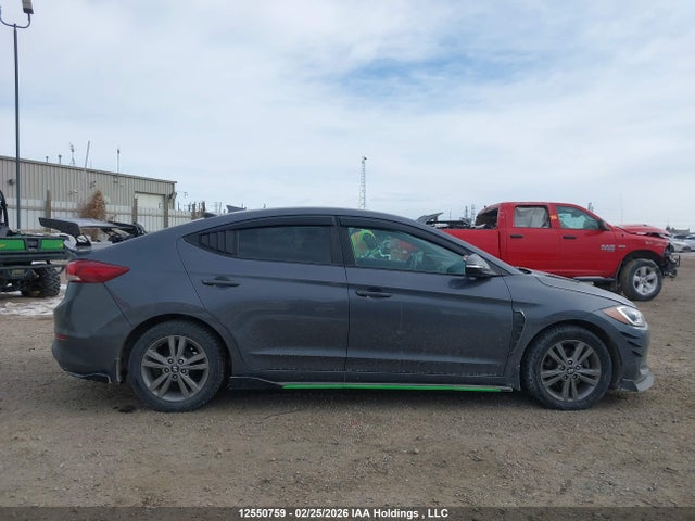 KMHD84LF5HU420760 Hyundai ELANTRA GL