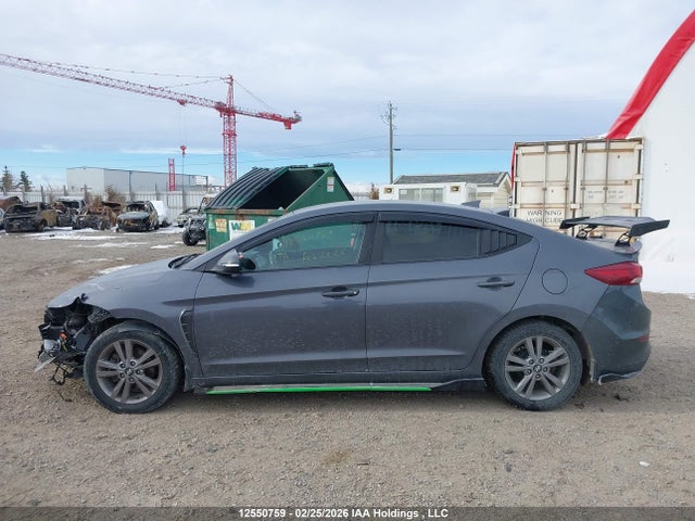 KMHD84LF5HU420760 Hyundai ELANTRA GL