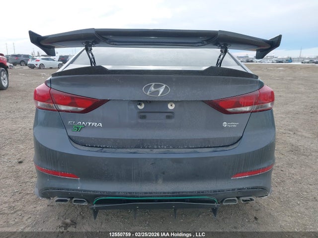 KMHD84LF5HU420760 Hyundai ELANTRA GL