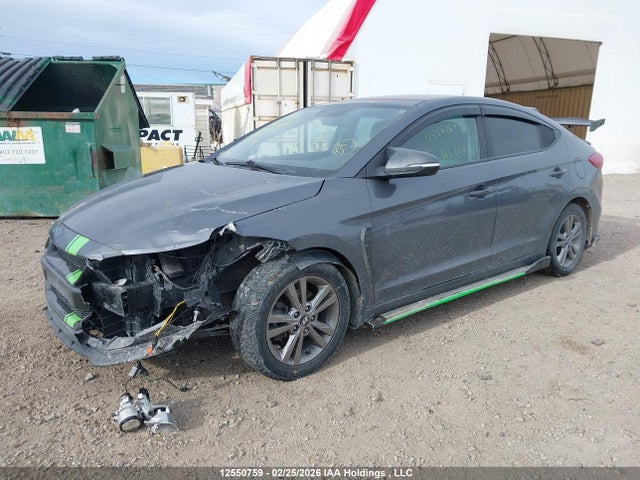 KMHD84LF5HU420760 Hyundai ELANTRA GL
