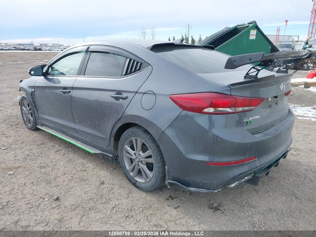 KMHD84LF5HU420760 Hyundai ELANTRA GL