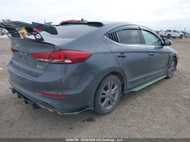 KMHD84LF5HU420760 Hyundai ELANTRA GL