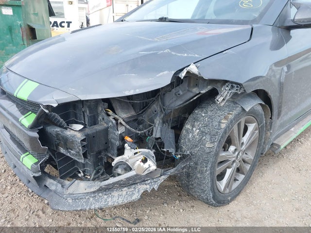 KMHD84LF5HU420760 Hyundai ELANTRA GL