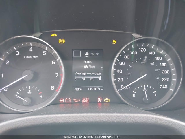 KMHD84LF5HU420760 Hyundai ELANTRA GL