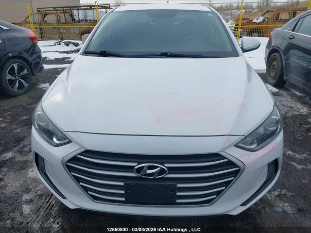 KMHD84LF9JU577522 Hyundai ELANTRA GL