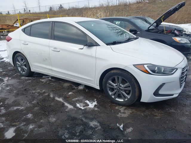 KMHD84LF9JU577522 Hyundai ELANTRA GL