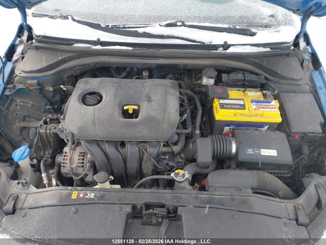 KMHD84LF9HU239404 Hyundai Elantra
