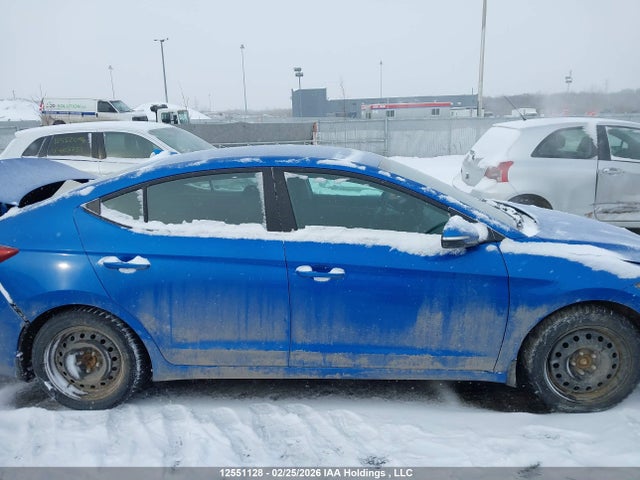 KMHD84LF9HU239404 Hyundai Elantra