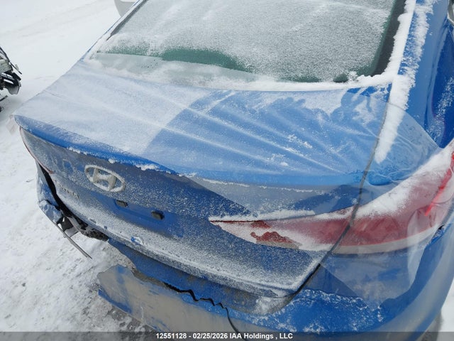 KMHD84LF9HU239404 Hyundai Elantra
