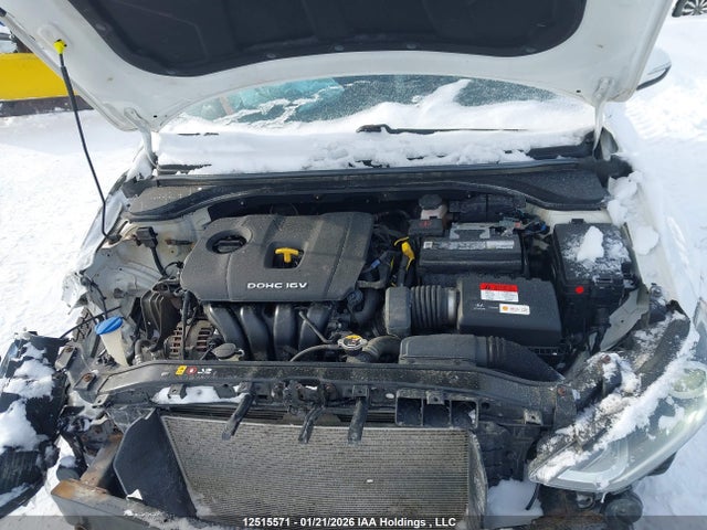KMHD84LF9JU558825 Hyundai ELANTRA GL