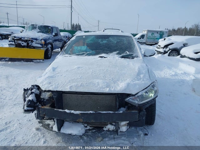 KMHD84LF9JU558825 Hyundai ELANTRA GL