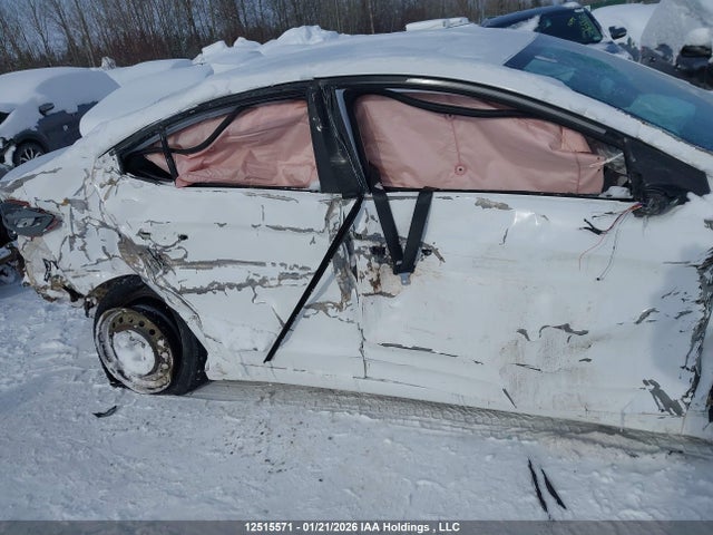KMHD84LF9JU558825 Hyundai ELANTRA GL