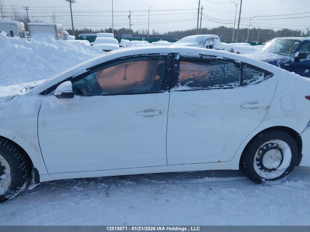 KMHD84LF9JU558825 Hyundai ELANTRA GL