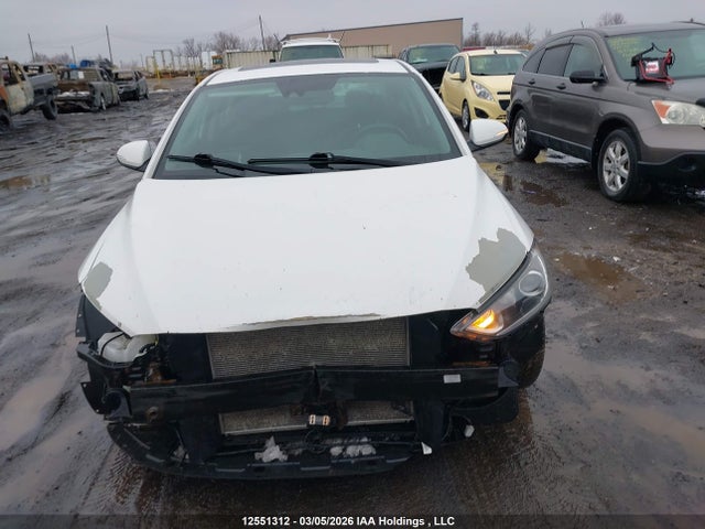 KMHD84LF6JU678999 Hyundai Elantra Limited