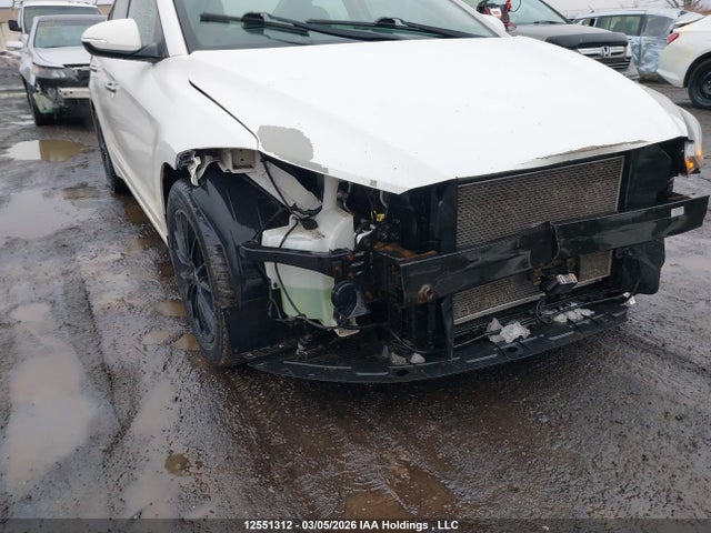 KMHD84LF6JU678999 Hyundai Elantra Limited