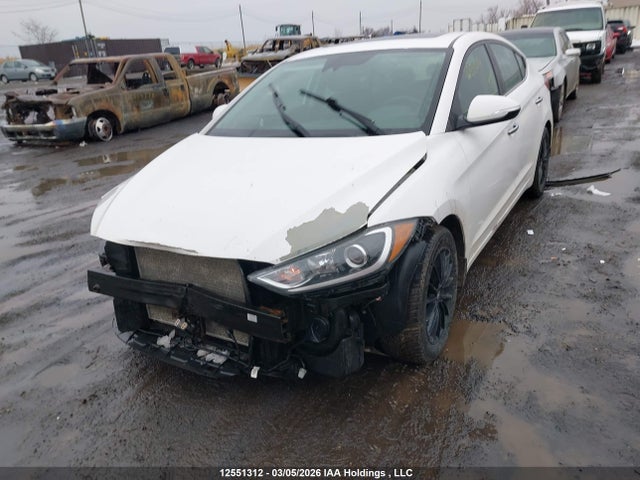 KMHD84LF6JU678999 Hyundai Elantra Limited