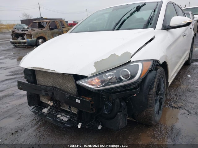 KMHD84LF6JU678999 Hyundai Elantra Limited