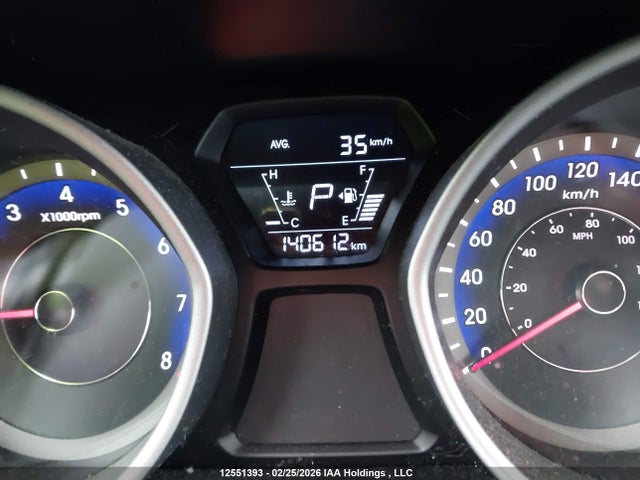 KMHDH4AE9GU629279 Hyundai Elantra Sport Appearance