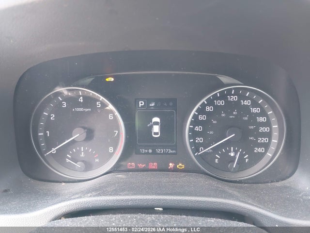 KMHD84LFXHU276820 Hyundai Elantra Se/value/limited