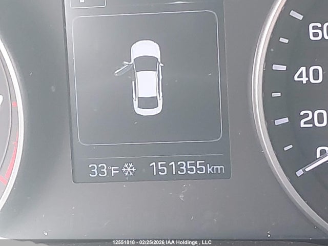 KMHD84LF5HU239738 Hyundai Elantra Se/value/limited