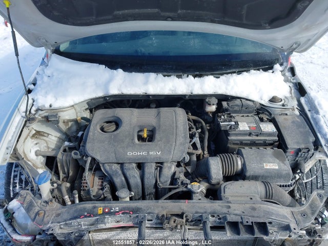 KMHD84LF7JU593718 Hyundai ELANTRA GL