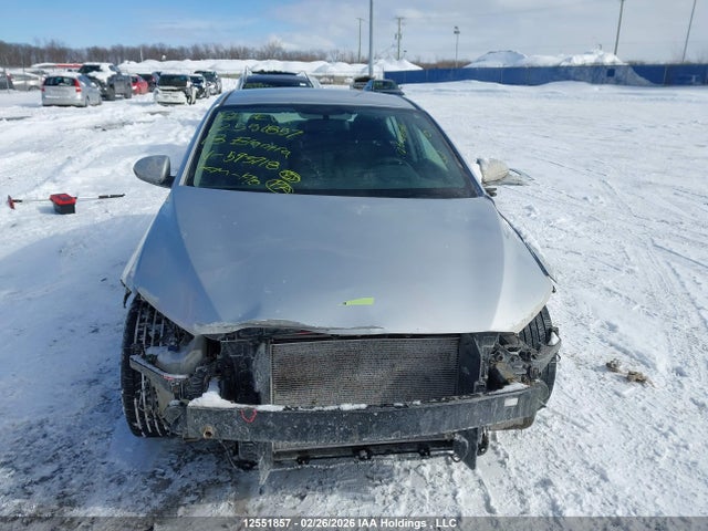 KMHD84LF7JU593718 Hyundai ELANTRA GL