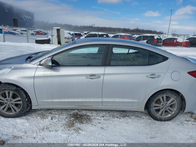 KMHD84LF7JU593718 Hyundai ELANTRA GL