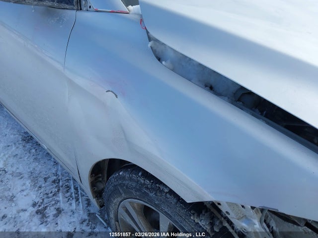 KMHD84LF7JU593718 Hyundai ELANTRA GL