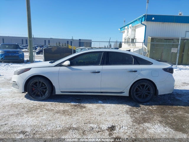 5NPE34AB1HH481833 Hyundai Sonata Sport/limited