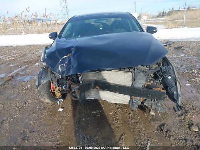 KMHD84LF8HU398768 Hyundai ELANTRA GL