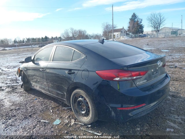 KMHD84LF8HU398768 Hyundai ELANTRA GL