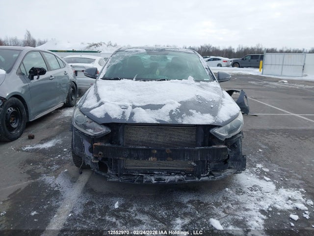 KMHD84LF4HU116674 Hyundai Elantra Se/value/limited