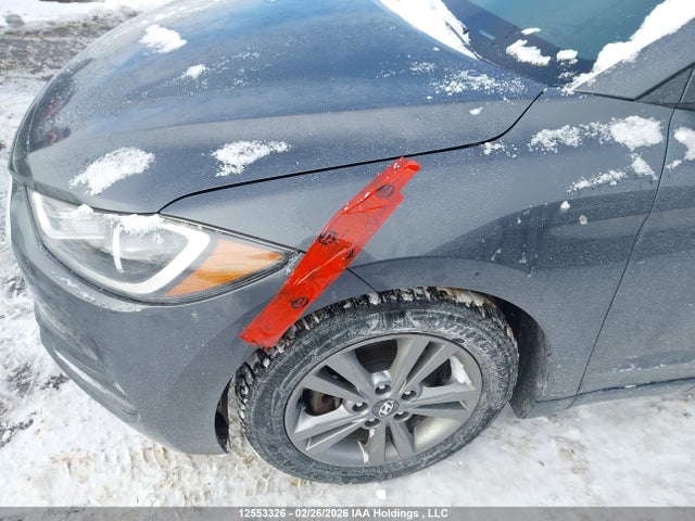 KMHD84LF9HU094252 Hyundai ELANTRA GL