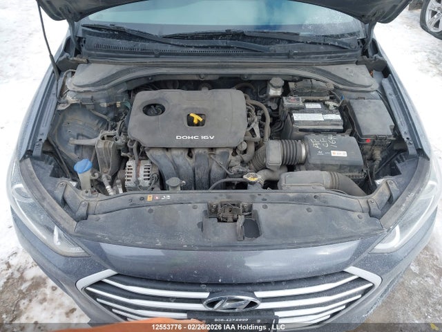 KMHD84LF9HU309127 Hyundai ELANTRA GL