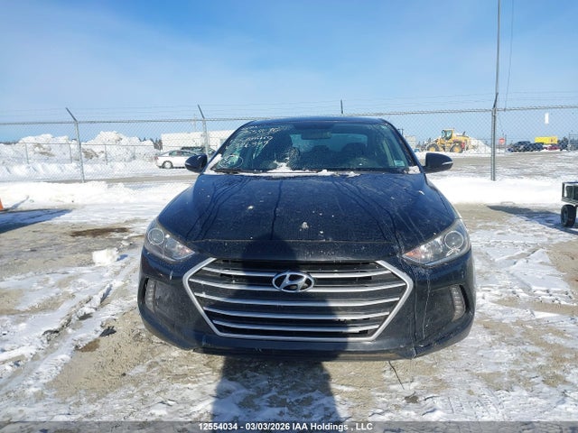 KMHD84LF2HU326349 Hyundai ELANTRA GL