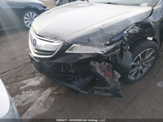 19UUB3F56HA800471 Acura TLX TECH
