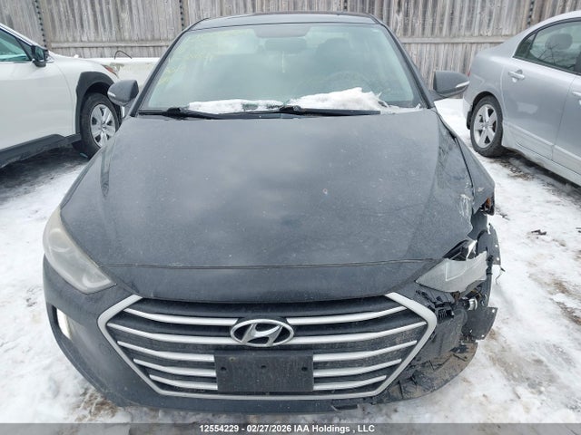 KMHD84LF4JU581557 Hyundai Elantra Sel/value/limited
