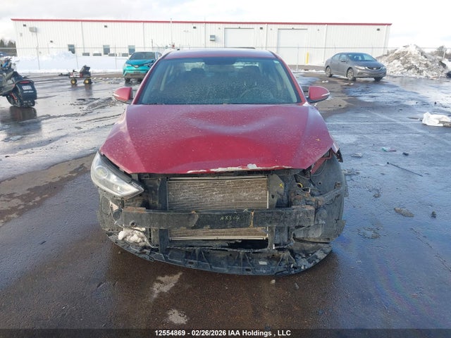 KMHD84LF5JU570552 Hyundai ELANTRA GL