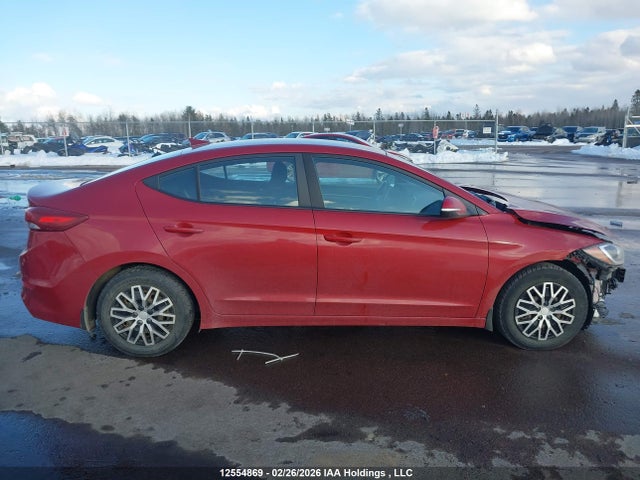KMHD84LF5JU570552 Hyundai ELANTRA GL