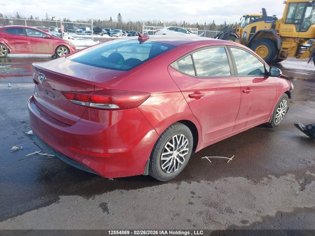 KMHD84LF5JU570552 Hyundai ELANTRA GL
