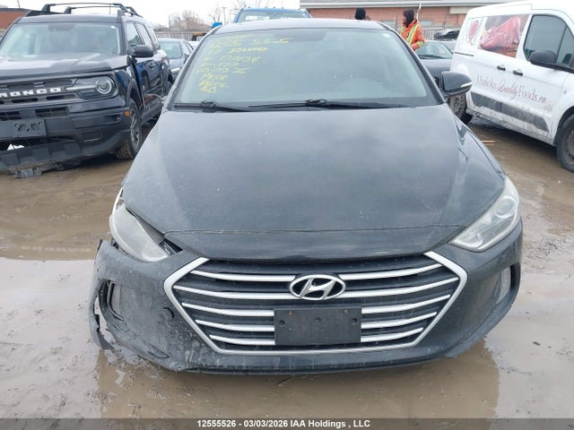 KMHD84LF9HU177034 Hyundai Elantra Gls