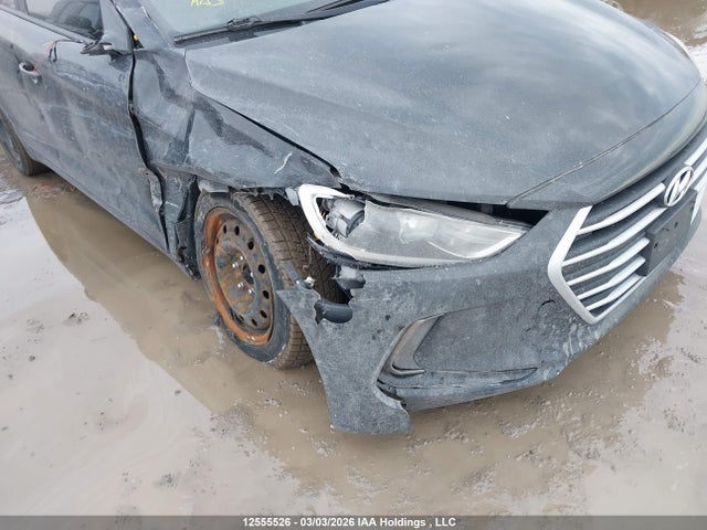 KMHD84LF9HU177034 Hyundai Elantra Gls