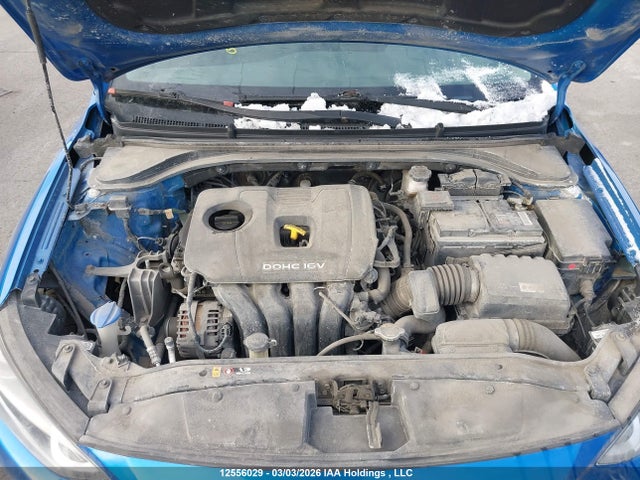 KMHD84LF8JU485365 Hyundai ELANTRA GL