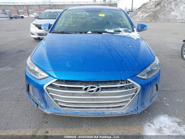 KMHD84LF8JU485365 Hyundai ELANTRA GL