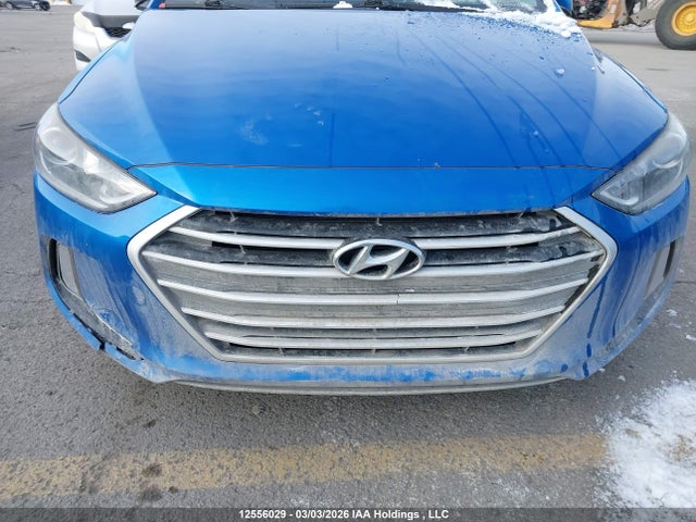 KMHD84LF8JU485365 Hyundai ELANTRA GL