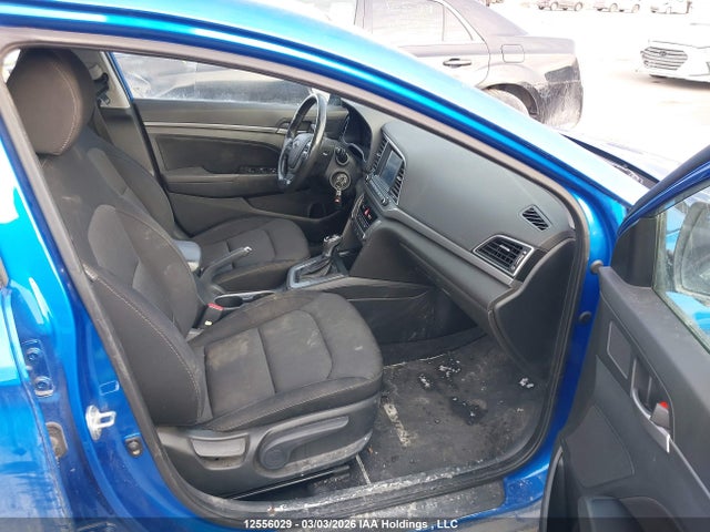 KMHD84LF8JU485365 Hyundai ELANTRA GL