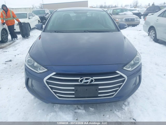 12556035 :رقم المزاد ، KMHD84LF2HU306876 vin ، 2017 Hyundai Elantra Se/value/limited مزاد بيع
