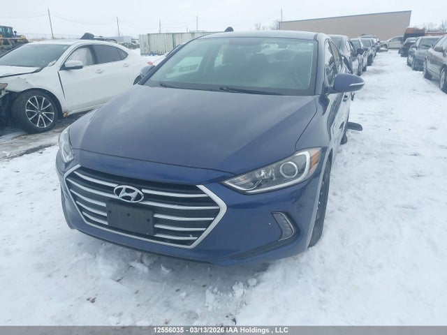 12556035 :رقم المزاد ، KMHD84LF2HU306876 vin ، 2017 Hyundai Elantra Se/value/limited مزاد بيع