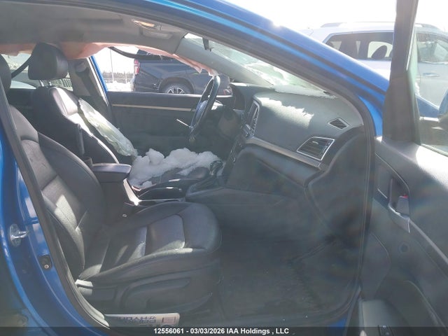 KMHD84LF0JU567476 Hyundai Elantra Gls